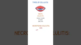 ORBITAL & NECROTIZING CELLULITIS