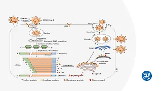 Journal Club: Atypical phenomena of COVID-19 induced ARDS