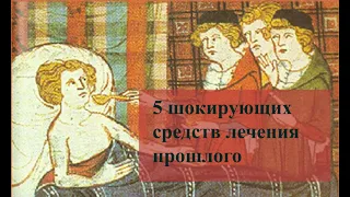 5 шокирующих фактов о средствах лечения прошлого