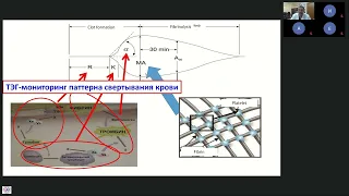 Синьков Сергей: Периоперационное ведение пациентов с нарушениями системы гемостаза: вклад кафедры