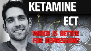 Ketamine vs ECT for depression: what studies don't tell you - Dr. Kaveh LIVE