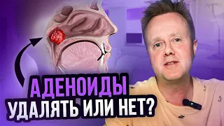 Последствия УДАЛЕНИЯ АДЕНОИДОВ и ГЛАНД. А нужно ли вообще УДАЛЯТЬ МИНДАЛИНЫ?