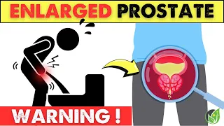 Signs 1 Month Before Prostate Enlargement and the Truth About Overlooked Foods
