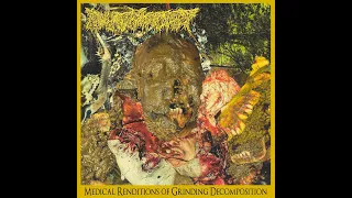 Pharmacist - Medical Renditions of Grinding Decomposition [Full Album - 2020]