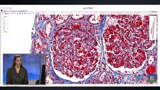 Pathology Insights: Medical Kidney Pathology with Leal Herlitz, MD