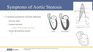 TAVR in 2022