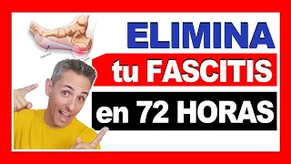 cómo ELIMINAR la Fascitis Plantar en 72 HORAS 🦶