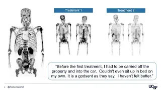 Lu-PSMA Radioligand Therapy