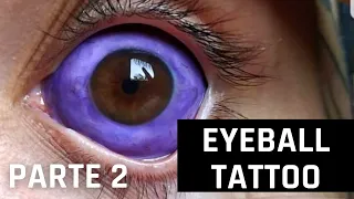 Eyeball Tattoo Dicas Importantes Parte 2.