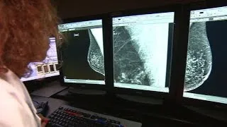 New guidelines recommend mammograms begin at age 50