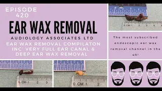 EAR WAX REMOVAL COMPILATION INC VERY FULL EAR CANAL & DEEP EAR WAX REMOVAL - EP420