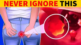 8 Critical Colon Cancer Symptoms You Should Never Ignore | Healthy Natural