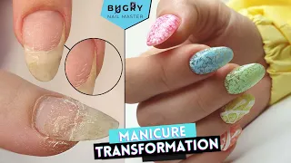 Manicure Transformation, Onycholysis? | Summer Manicure