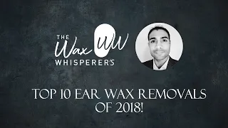 The Wax Whisperer's Top 10 Ear Wax Removals of 2018! - #349