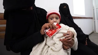 ЮНИСЕФ: тысячи детей в Йемене страдают от недоедания (новости)