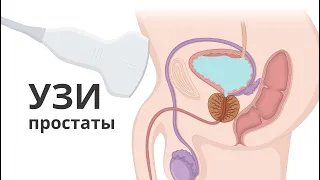 УЗИ простаты. Топ 5 ошибок при проведении ультразвуковой диагностики предстательной железы