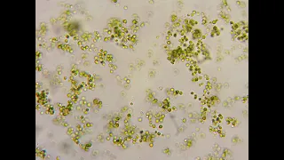 Хлорелла под микроскопом - Концентрат