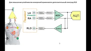 Схемотехника ЭКГ: ч.2. Входные узлы кардиографа для снятия потенциалов ЭКГ