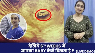 देखिये 6th Weeks में आपका Baby कैसे दिखता है ? | Sonography Week By Week Pregnancy | Dr Asha Gavade