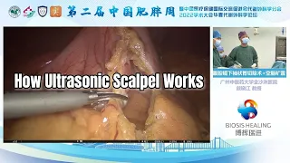 How Ultrasonic Scalpel Works | Ultrasonic Scalpel System G500 | Surgsci