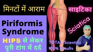 Sciatica dard kaise theek kare | साइटिका दर्द का इलाज | Piriformis Syndrome kya hota hai