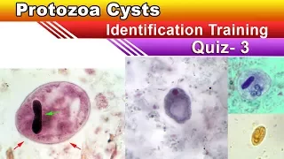 Protozoa Cysts Identification Training  Quiz ( Part 3 )