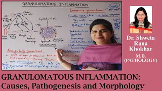 Granulomatous Inflammation: Causes, Pathogenesis and Morphology | Immune and Foreign body granulomas