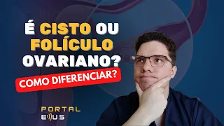 COMO DIFERENCIAR CISTO SIMPLES DE FOLÍCULO OVARIANO PELA ULTRASSONOGRAFIA?#shorts