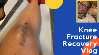 Knee Surgery | Patella Fracture Detailed Vlog and Recovery