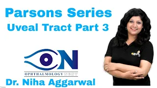 Parson Series Uveal Tract Part 3 || Dr. Niha Aggarwal