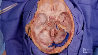 Intracranial Dissection of the Skull Base