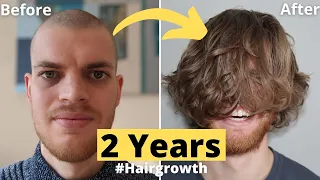 💇🏻💈Hair Growth Time Lapse 2 Years (24 Months) Men - From Buzz Cut