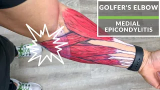 Medial Epicondylitis "Golfer's Elbow"