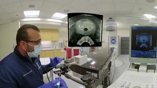Transperineal Techniques for Prostate Cancer Ultrasound and Fiducials ABS Virtual Reality (360 VR)