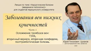 Болезни вен, часть 3.  Осложнения венозного тромбоза.  Лекция для студентов медуниверситета.