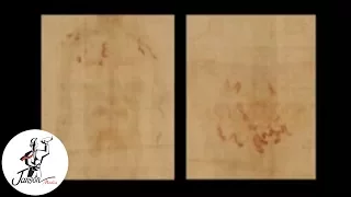 The Shroud of Turin Blood Stains