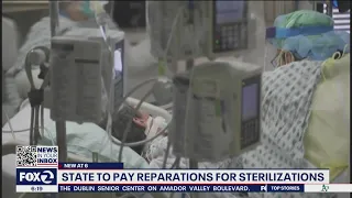 California to pay reparations for sterilizations