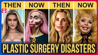 50 Celebrity Plastic Surgery Disasters | You’d Never Recognize Today