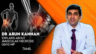 Avascular necrosis (AVN) Hip Condition & Treatment & Risk Factors in Tamil / Dr Arun Kannan Apollo