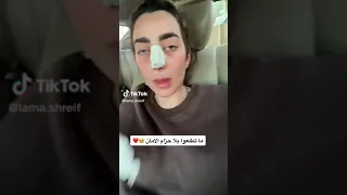 لمي شريف عملت عملية تجميل😱