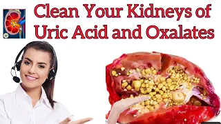 Tips to Cleanse Your Kidneys of Uric Acid and Oxalates