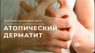 Что может разбудить атопический дерматит?