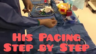 His pacing - DIY #hispacing #dothehis #physiologicalpacing #hisbundlepacingtechnique #Pacemaker