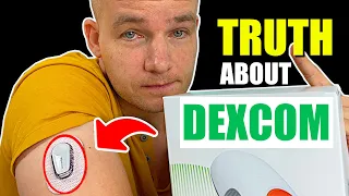 Dexcom G6 | My Honest Review after 7 Months