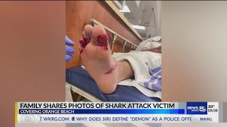 Family share photos of shark attack victim