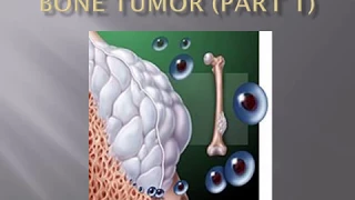 bone tumors I