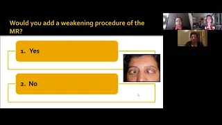 Lecture: Surgical Strategies: Strabismus