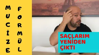 Ve SONUÇ !! Saçlarım Yeniden Çıktı l Saç Çıkaran Mucize Doğal Kür l Saç Dökülmesine Karşı Çözüm