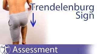 Trendelenburg Sign | Hip Abductor Weakness