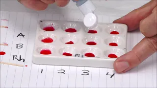 Blood Typing Activity